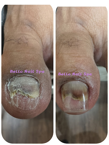 Bello Nail Spa