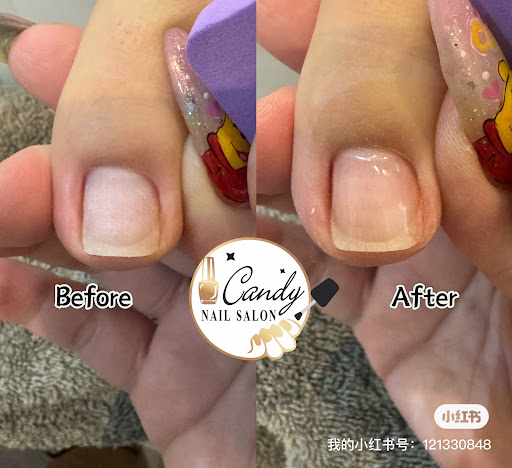 Nail